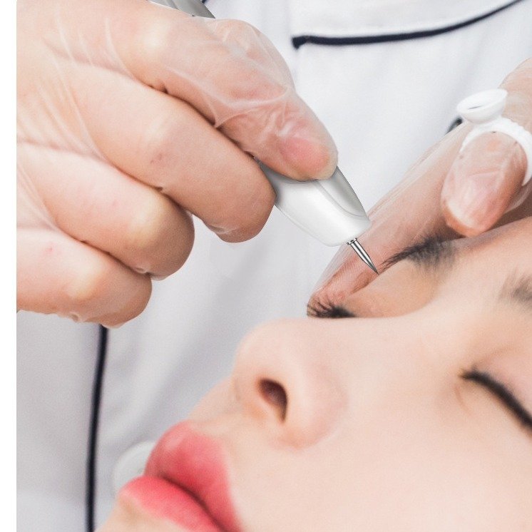 Small White Artifact Beauty Salon Blue Light Repair Electric Mole Removal Pen - Image 2